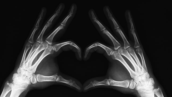 Love You To The Bone !, human hand x-ray, bones, heart, x-ray, love, 3d and abstract, HD wallpaper