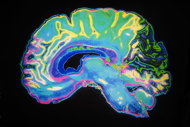 brain, radiography, dye color, HD wallpaper