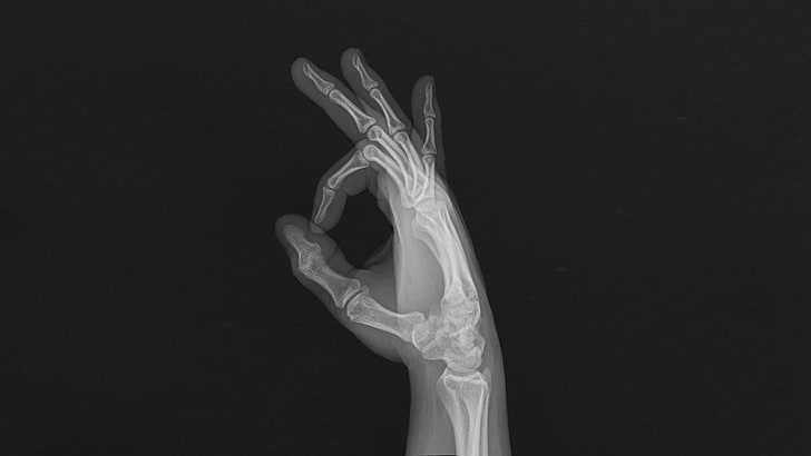 hands, bones, x-rays, fingers, HD wallpaper