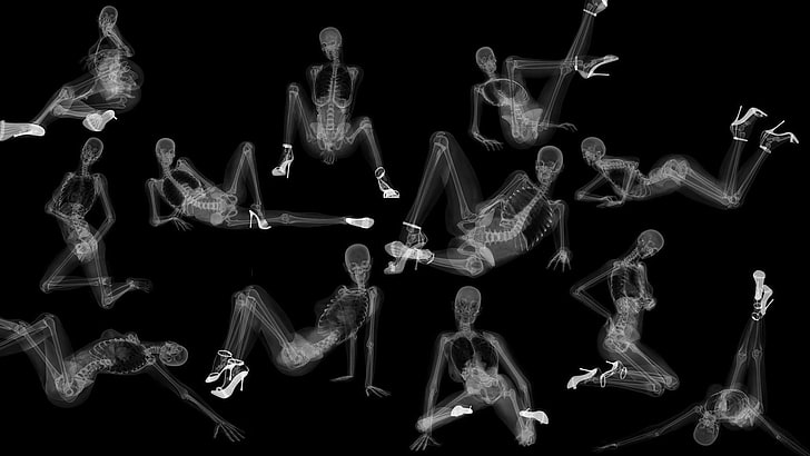 рентгеновское изображение всего тела, стиль, девушки, рентген, HD обои
