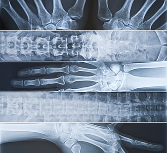 اليدين والأصابع والعمود الفقري والصور الشعاعية، خلفية HD HD wallpaper